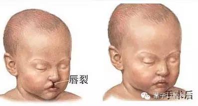 怀孕用麻药对胎儿有影响吗,孕妇可以做口腔麻药吗