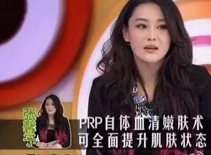 prp自体血清修复疗法,prp自体血清注射面部恢复期