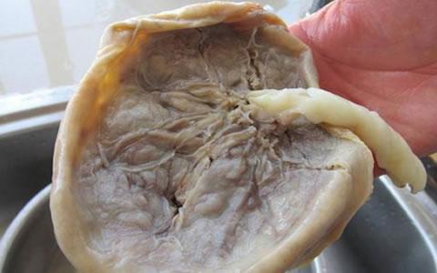 胎盘不是很好对宝宝有啥影响,胎盘如何处置对宝宝好