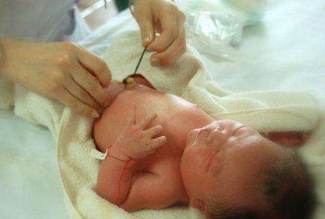 月嫂课堂练习新生儿脐带消毒,宝宝脐带护理月嫂处理