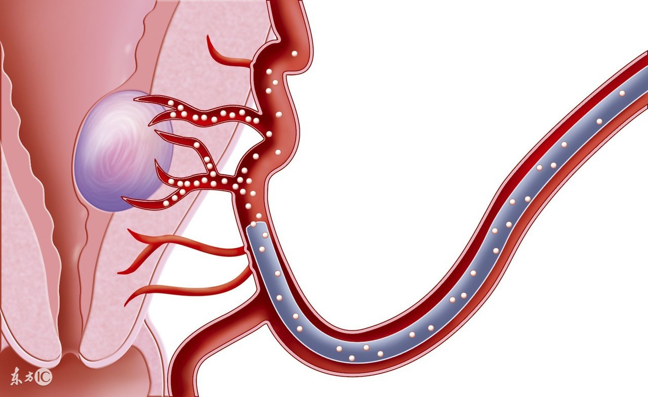 女性最大的私密问题，你还敢轻忽吗？