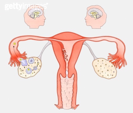 卵巢囊肿影响怀孕吗,右侧卵巢囊肿怎么办