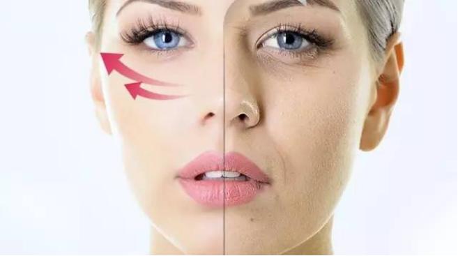 法令纹深用埋线好还是超声刀好,超声刀去除法令纹多少钱