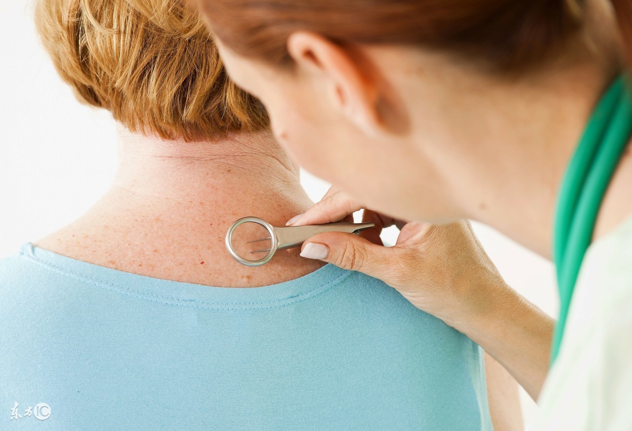 激素皮炎和皮肤屏障受损的区别,激素皮炎和湿疹的区别