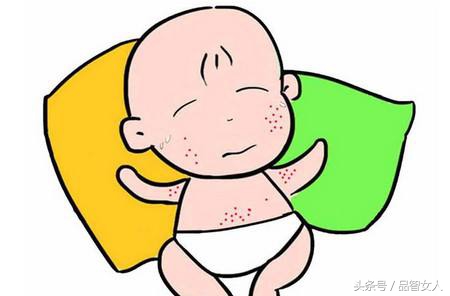 一岁宝宝突然高烧是幼儿急疹吗,婴儿急疹高烧超过40