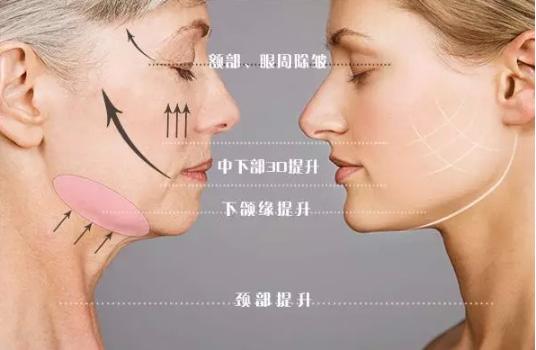 线雕的十大骗局,揭秘线雕埋线你不知道的内幕