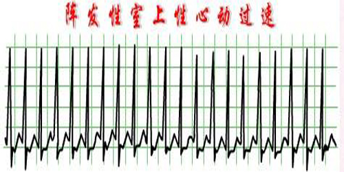 急救用药详解视频,一线救治完整流程
