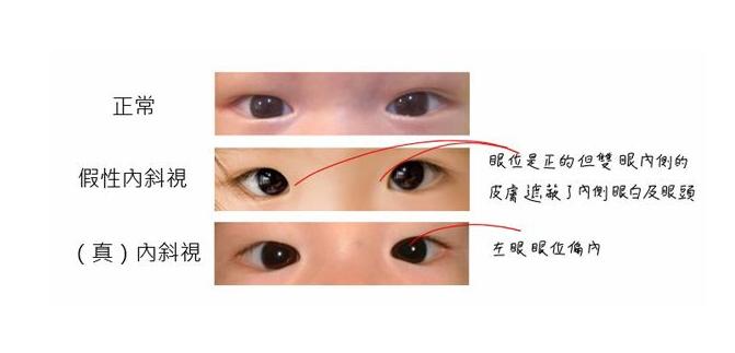 育儿知识大全妈妈的烦恼,妈妈育儿中的小禁忌