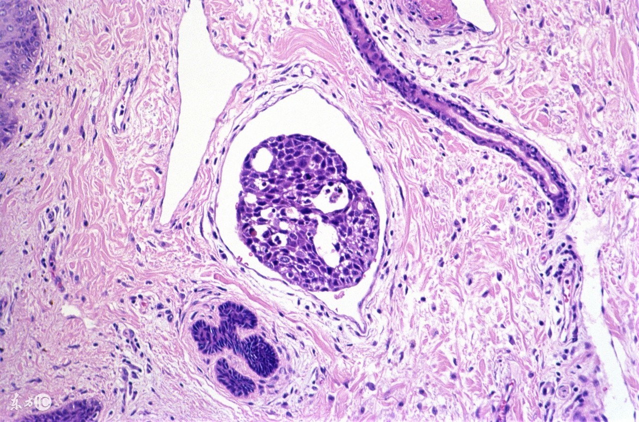 天下无癌论潘德孚,天下无癌论书