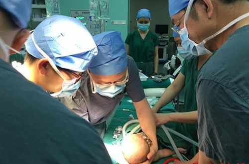 宝宝摔下床后脑淤血,孩子摔下床脑震荡表现