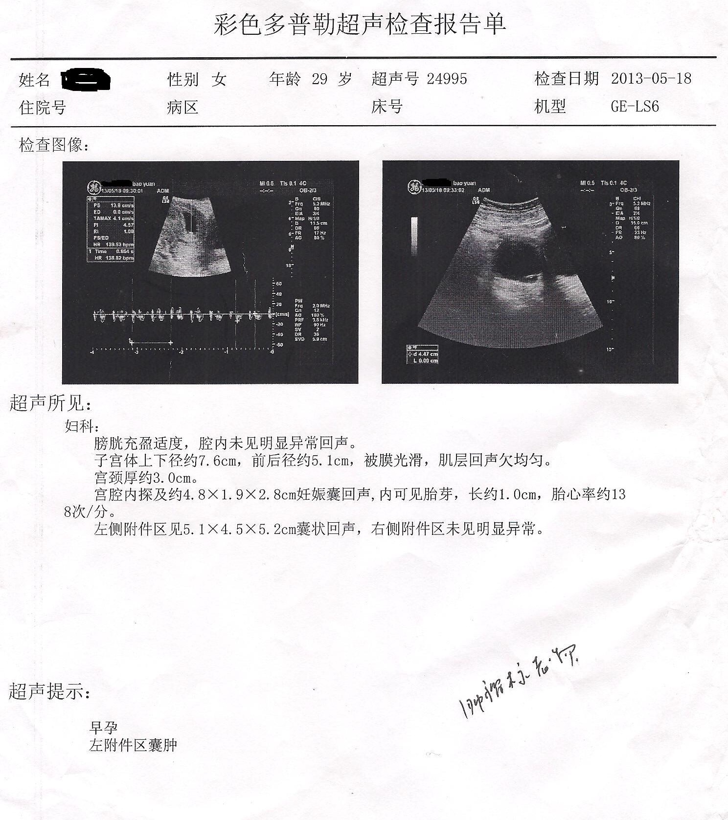 做b超看到的宝宝,谈谈准妈妈如何做b超
