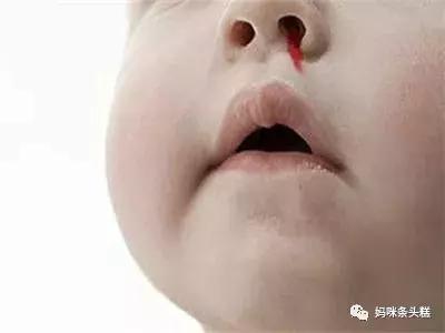 孩子流鼻血如何判断血液疾病,孩子流鼻血是脾胃不好吗
