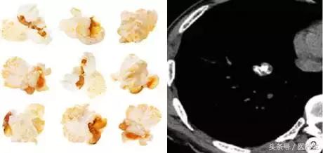 舌尖上的中医药论文,舌尖上的医疗