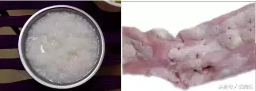 舌尖上的中医药论文,舌尖上的医疗