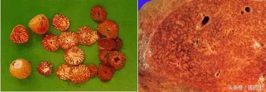 舌尖上的中医药论文,舌尖上的医疗