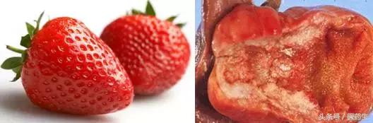 舌尖上的中医药论文,舌尖上的医疗