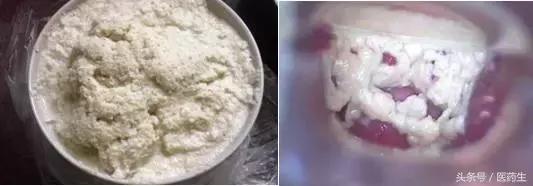 舌尖上的中医药论文,舌尖上的医疗