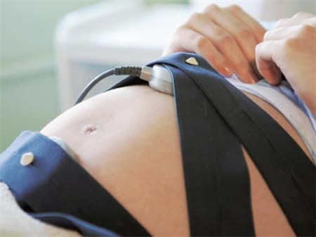 胎心监护会测到妈妈腹部脉搏吗,电脑胎心监护图怎么看