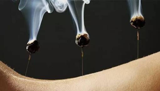 艾灸的正确时间和艾灸方法,艾灸前关注事项有哪些