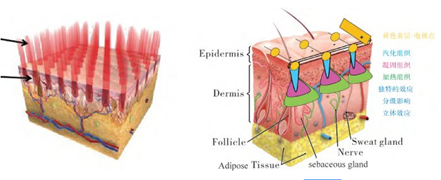 激光对皮肤有哪些危害,激光对细胞的影响