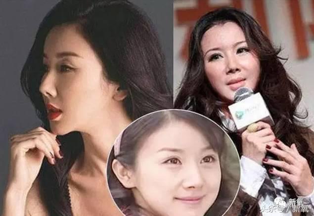 韩安冉这次鼻子修复是在哪修复的,韩安冉现在做的鼻子是什么款的