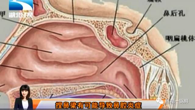 孙俪教高鼻梁方法,孙俪的高鼻梁怎么来