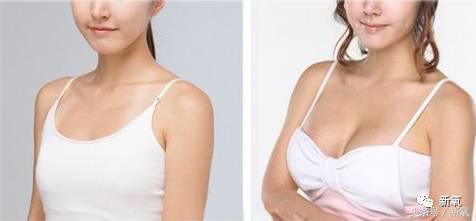 韩安冉这次鼻子修复是在哪修复的,韩安冉现在做的鼻子是什么款的