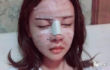 韩安冉这次鼻子修复是在哪修复的,韩安冉现在做的鼻子是什么款的