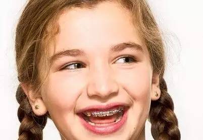 宝宝地包天应如何防治,宝宝出现地包天怎么办