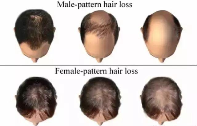 美颜相机都遮不住皱纹了,美颜相机美颜总掉怎么回事