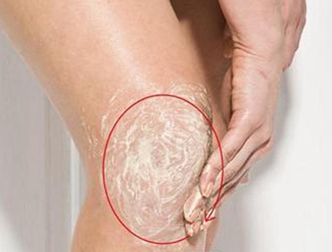 膝盖上黑黑的东西怎么去除,膝盖黑黑的洗不掉是什么原因