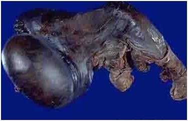 闲得蛋疼的症状,闲得蛋疼怎么治