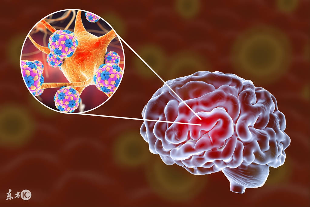 脑炎后遗症记忆差了怎么康复,三岁小孩脑炎后遗症康复操