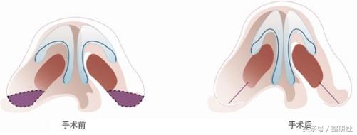 甜美公主养成记,甜妹养成记