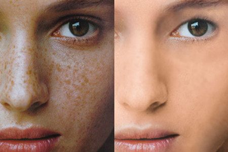 烟酰胺和氢醌霜哪个祛斑效果好,氢醌霜和壬二酸哪个祛斑效果更好