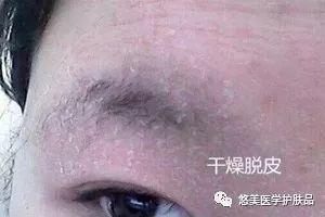 鑸掑┓鎶よ偆,鑸掑┓绁涚棙