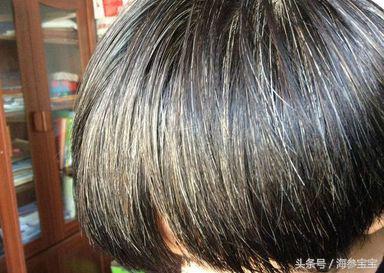 学习压力大，孩子长了白头发怎么办？一些小知识教你如何应对