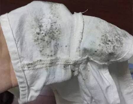 处理衣服发霉的小妙招,衣服发霉有小白点怎么处理