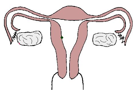 妇一科疾病自检大全,妇科疾病自检大全图解