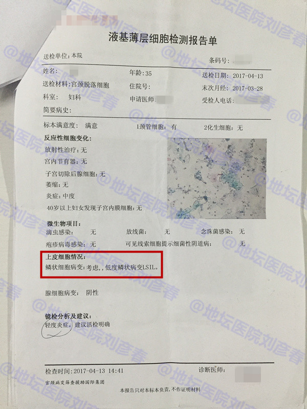 尖锐性湿疣报告阴性后还会传染吗,尖锐性湿疣会在医院病历记载吗