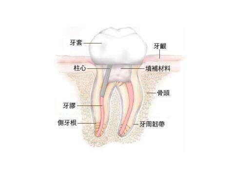 什么时候牙齿需要根管治疗,根管治疗需要几次才能彻底治好
