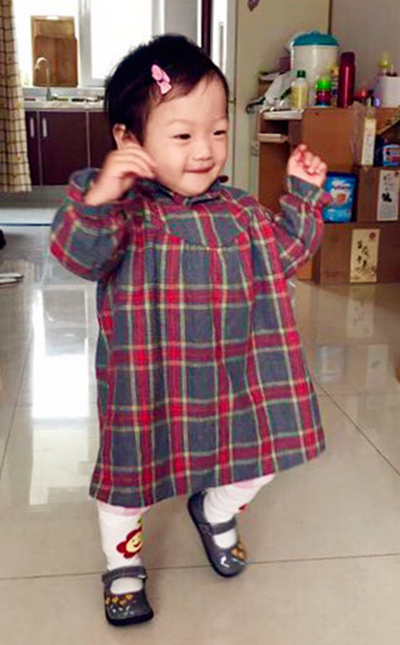 孩子异常走路步态,孩子步态异常家长您留意了吗