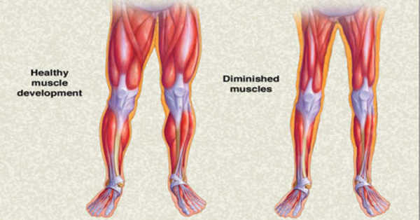 膝关节损伤肿胀的消除方法,关节肿胀完全消除