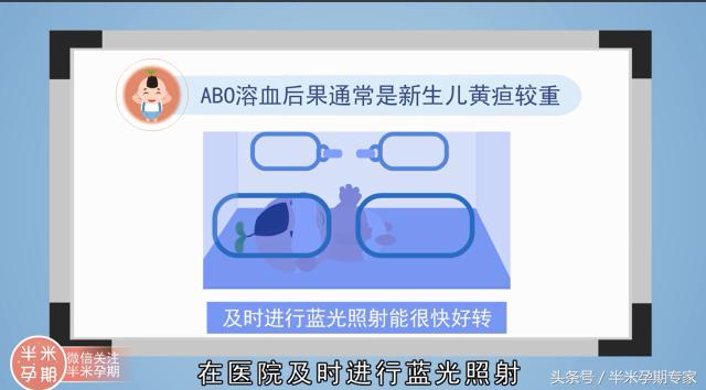 abo溶血和rh溶血区别,abo溶血和rh溶血哪个更常见