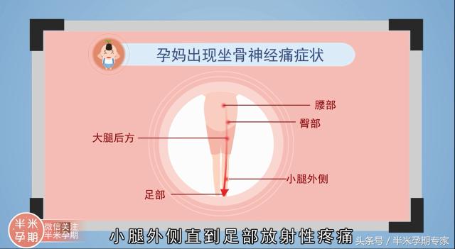 孕期腰背痛瑜伽动作,孕妇肚子疼腰背痛怎么办