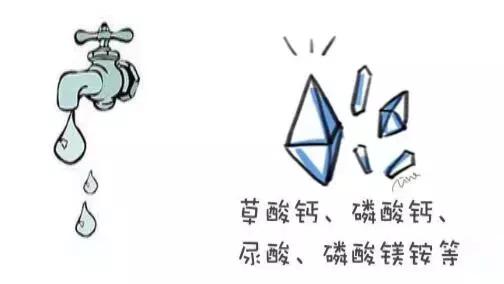 对尿结石有帮助的产品,尿路结石神器