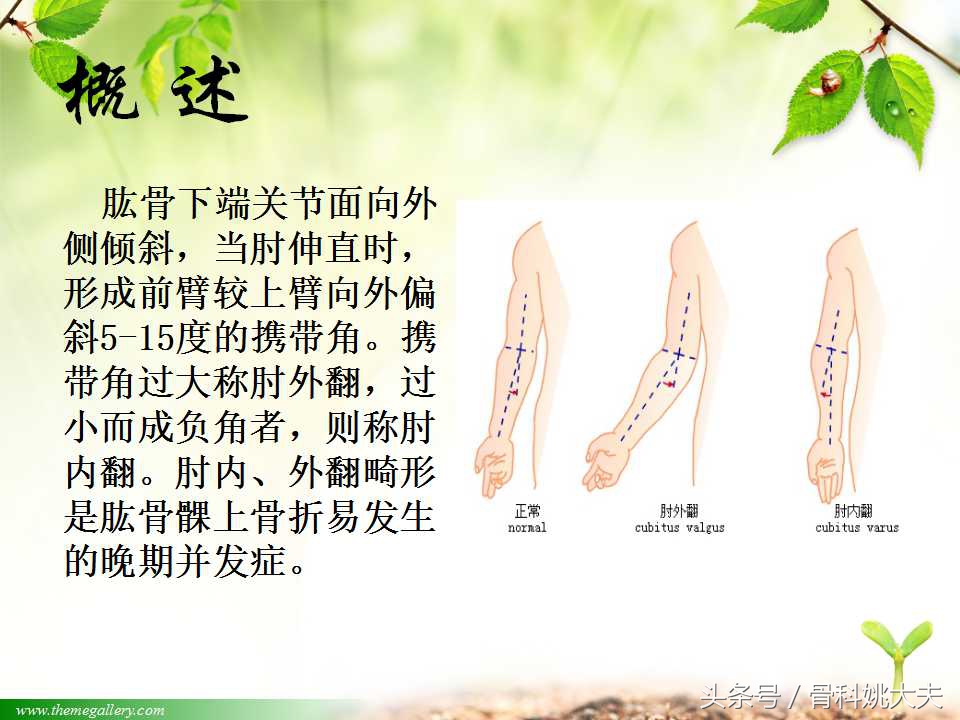 儿童肱骨干骨折处理方法,小孩胳膊肱骨骨折恢复最佳的方法