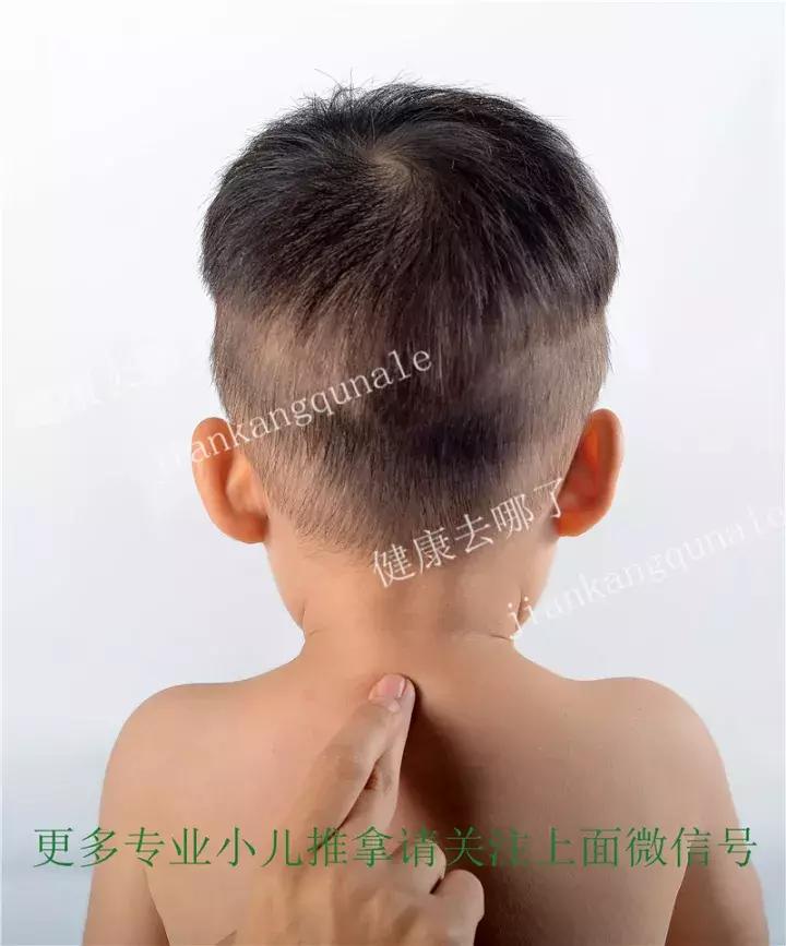 鼻炎小儿推拿手法,小儿鼻炎推拿常用手法