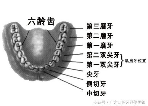 第一上磨牙是龋齿怎么办,乳磨牙出现龋齿大洞怎么办