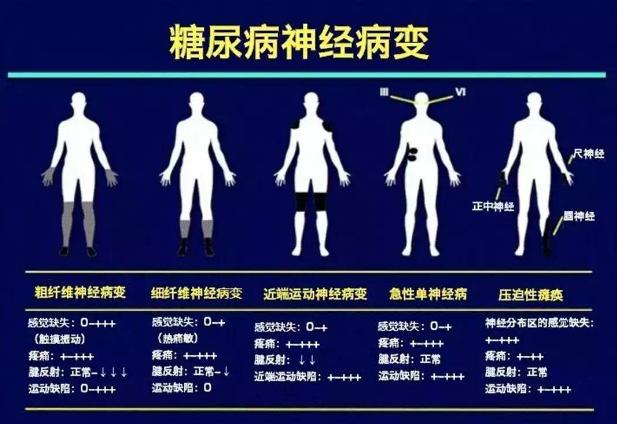 糖友抗糖的好方法,如何预防糖尿病神经病变